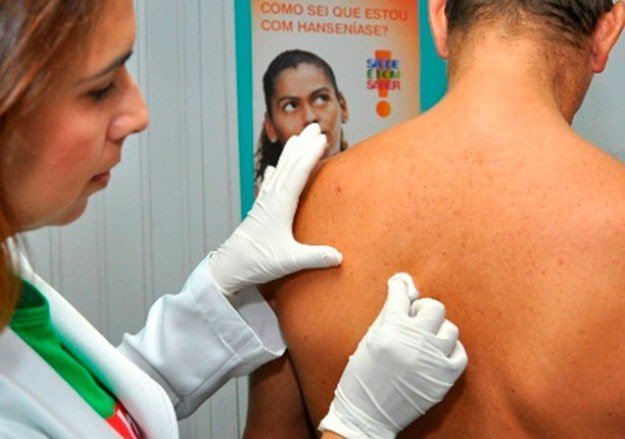 Foto divulgação
